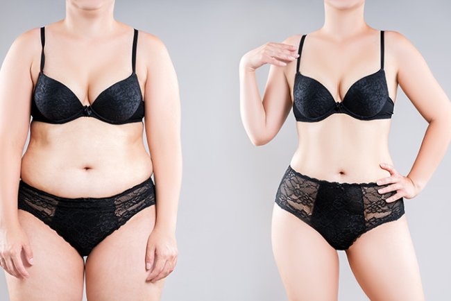 Tummy Tuck Surgery in Dubai: A Comprehensive Guide to Procedure, Cost, and Results